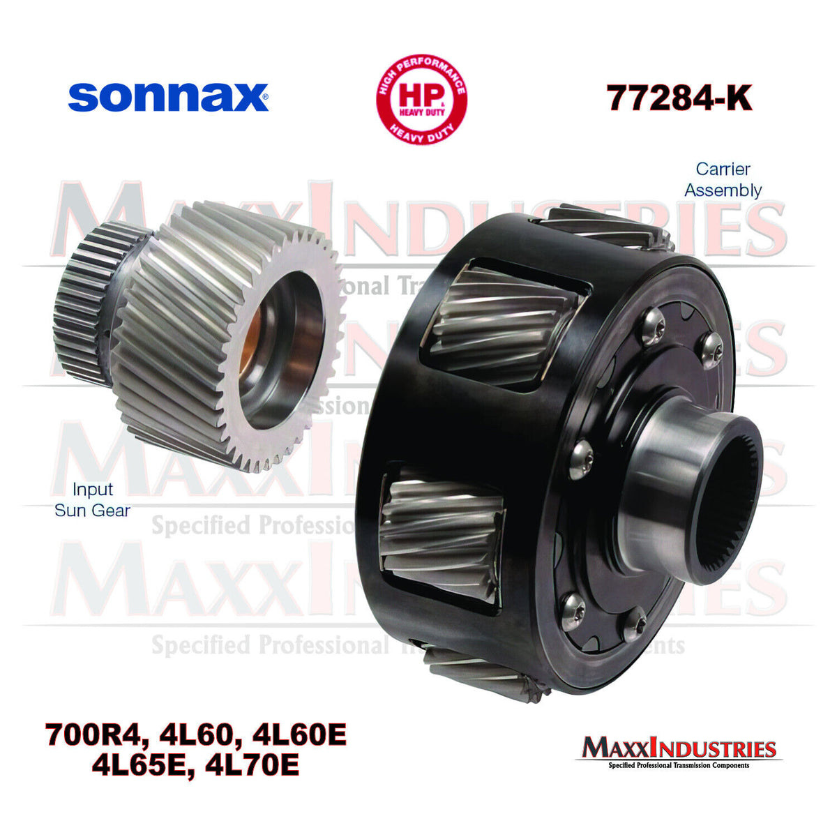 Sonnax 77284K Transmission Front Kit, 2.84 Ratio w/ Input Sun